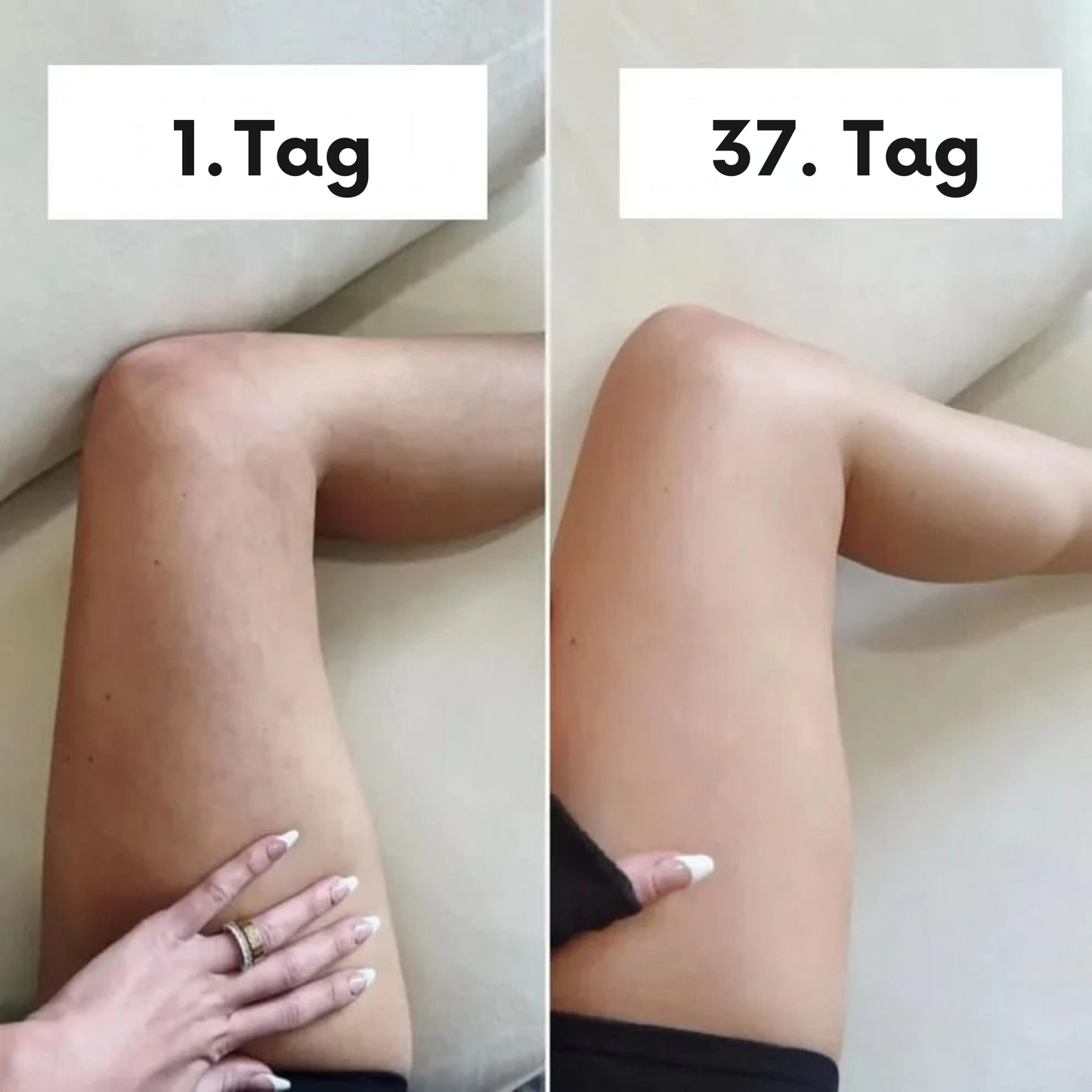 Skineah - Anti Cellulite Massager