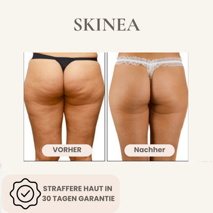 Body Gua Sha - Cellulite Frei in 30 Tagen