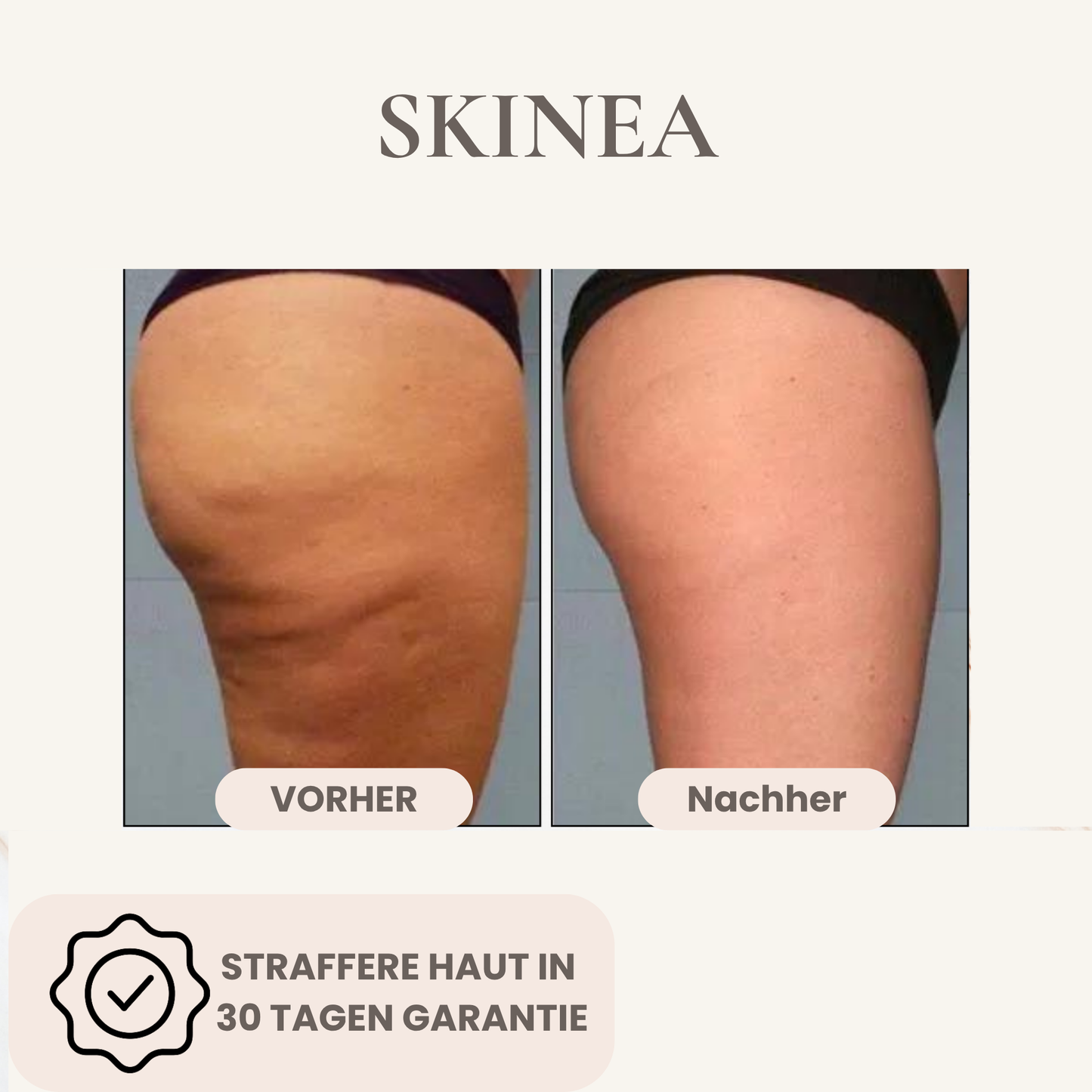Body Gua Sha - Cellulite Frei in 30 Tagen