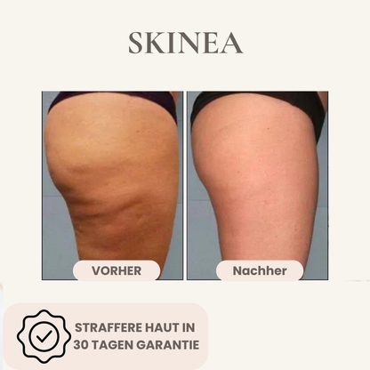 Body Gua Sha - Cellulite Frei in 30 Tagen
